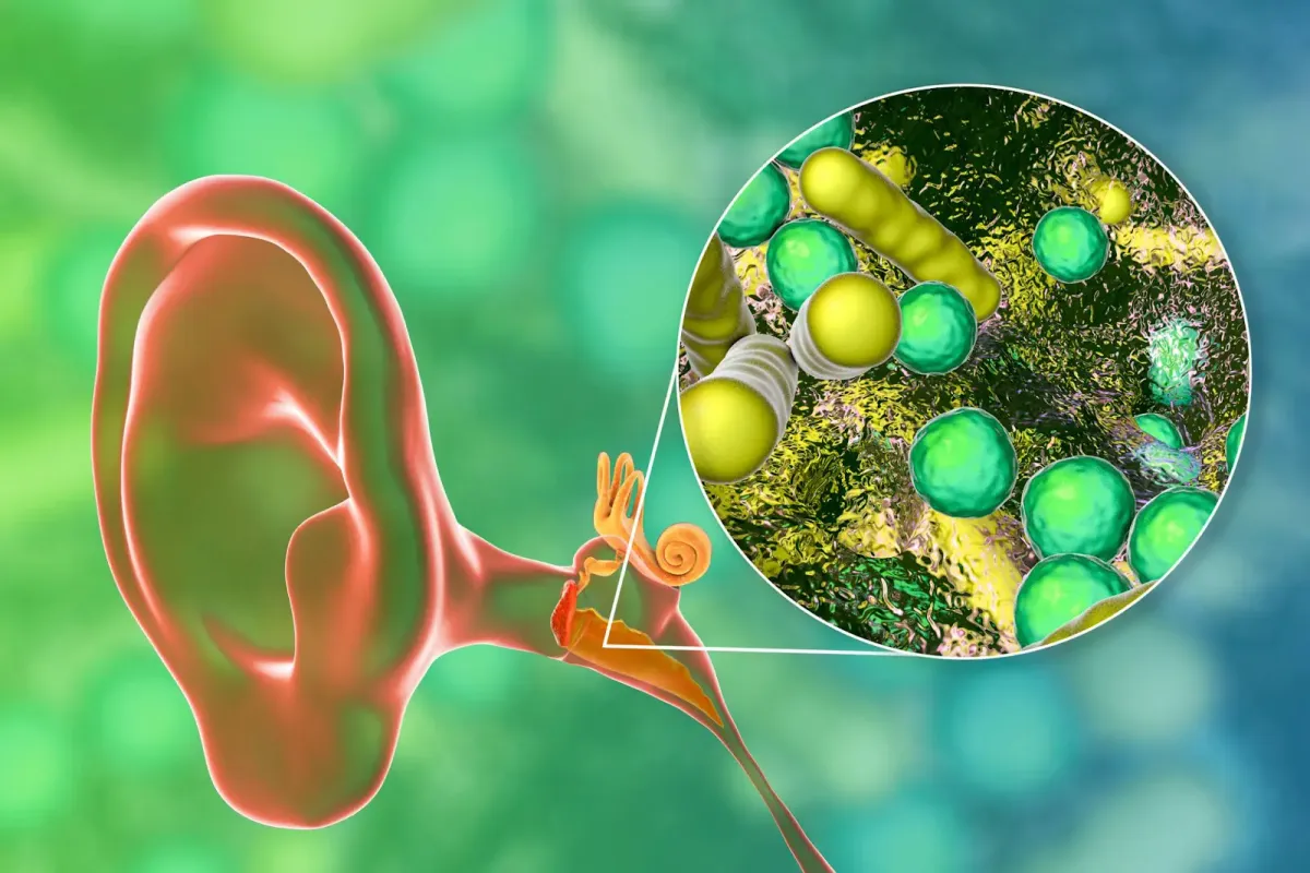 What you need to know to understand the connection between tinnitus and allergies